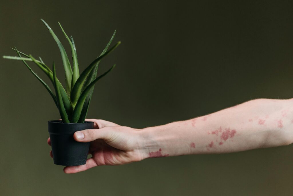 rashes and health conditions