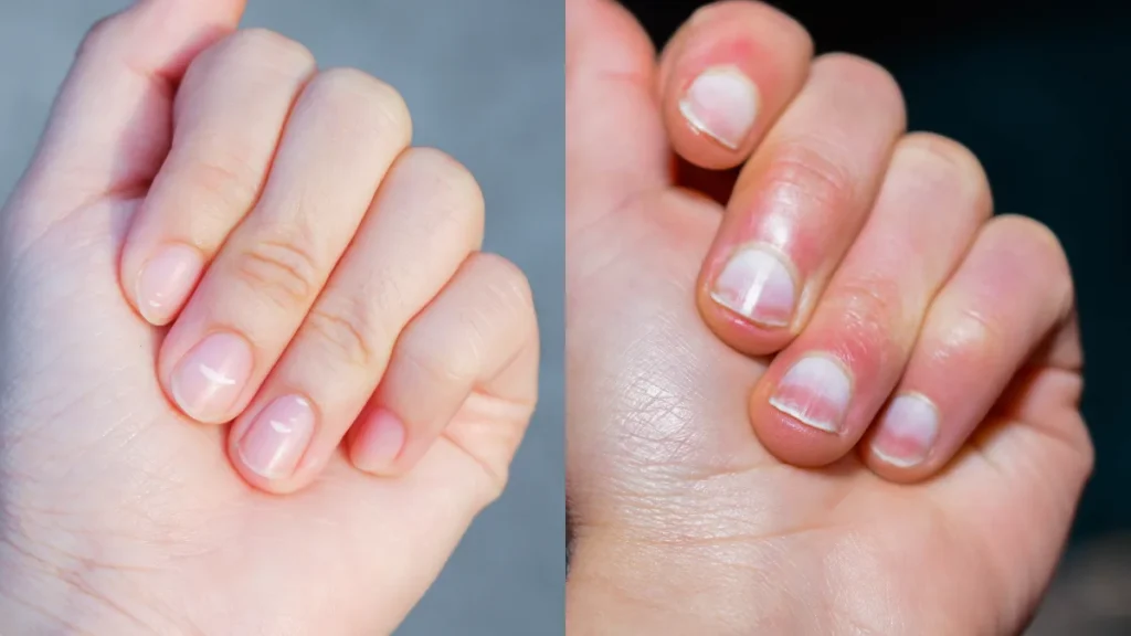 Did You Know Your Nails Are Technically Hair?